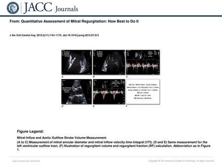 J Am Coll Cardiol Img. 2012;5(11): doi: /j.jcmg Figure Legend: