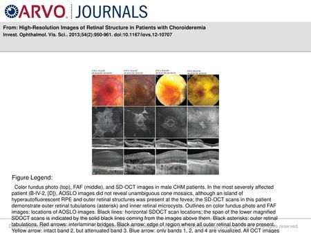 Invest. Ophthalmol. Vis. Sci ;54(2): doi: /iovs Figure Legend: