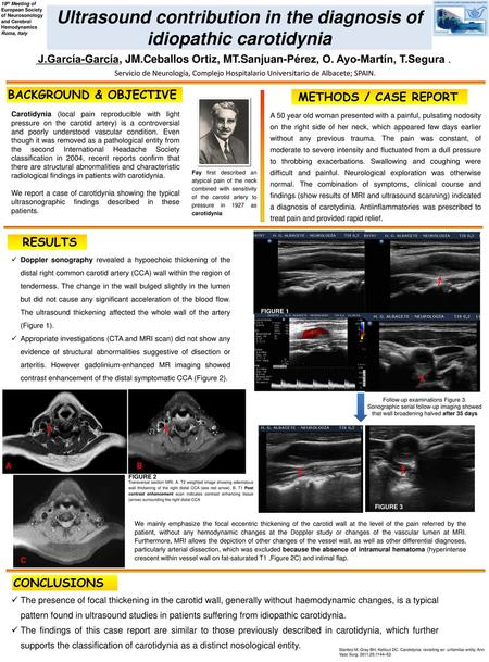 Ultrasound contribution in the diagnosis of idiopathic carotidynia