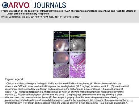 From: Evaluation of the Toxicity of Intravitreally Injected PLGA Microspheres and Rods in Monkeys and Rabbits: Effects of Depot Size on Inflammatory Response.