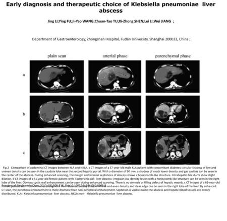 Early diagnosis and therapeutic choice of Klebsiella pneumoniae liver abscess Jing LI;Ying FU;Ji-Yao WANG;Chuan-Tao TU;Xi-Zhong SHEN;Lei LI;Wei JIANG.