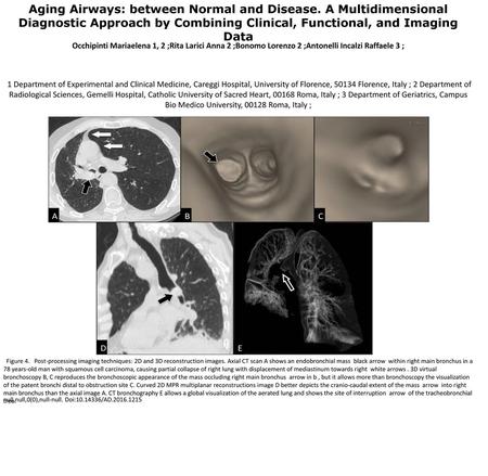 Aging Airways: between Normal and Disease