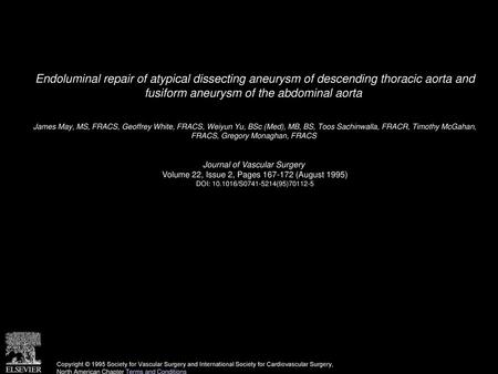 Endoluminal repair of atypical dissecting aneurysm of descending thoracic aorta and fusiform aneurysm of the abdominal aorta  James May, MS, FRACS, Geoffrey.