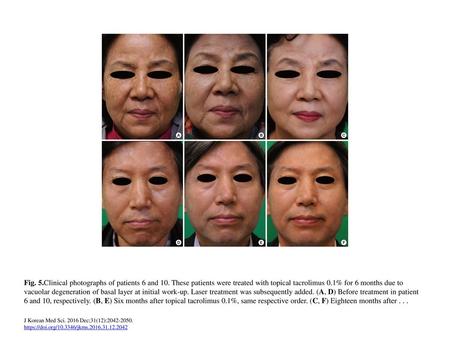 Fig. 5. Clinical photographs of patients 6 and 10