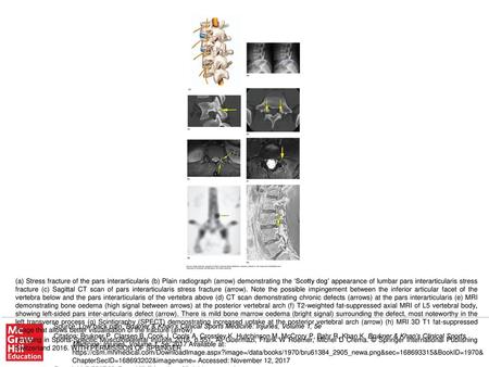 Imaging in Sports-Specific Musculoskeletal Injuries 2016, p