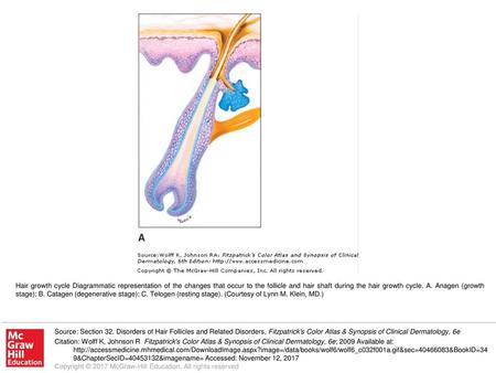 Hair growth cycle Diagrammatic representation of the changes that occur to the follicle and hair shaft during the hair growth cycle. A. Anagen (growth.