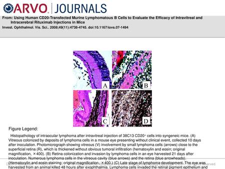 From: Using Human CD20-Transfected Murine Lymphomatous B Cells to Evaluate the Efficacy of Intravitreal and Intracerebral Rituximab Injections in Mice.