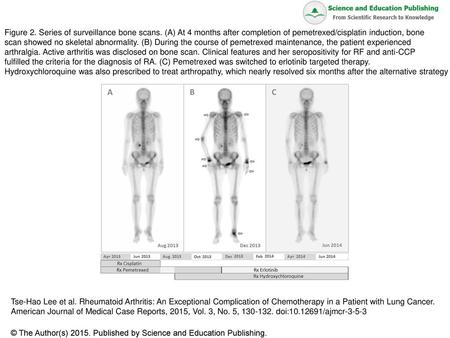 Figure 2. Series of surveillance bone scans