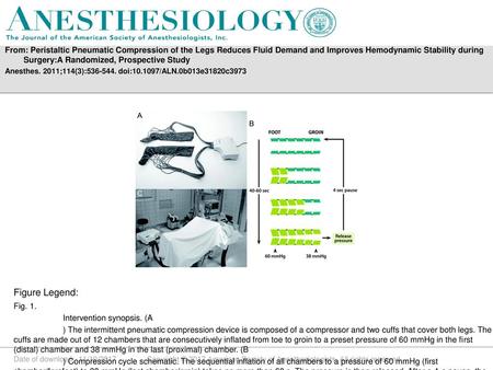 From: Peristaltic Pneumatic Compression of the Legs Reduces Fluid Demand and Improves Hemodynamic Stability during Surgery:A Randomized, Prospective Study.