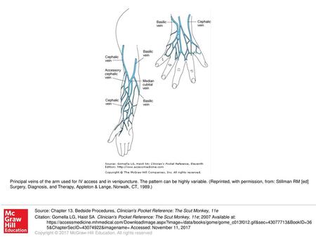 Principal veins of the arm used for IV access and in venipuncture