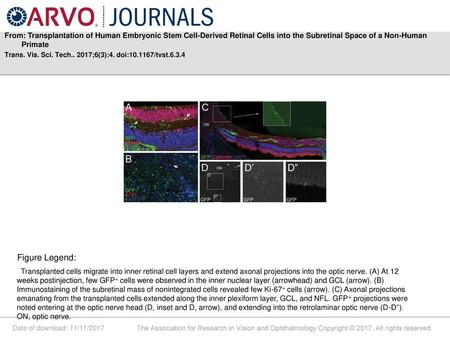 From: Transplantation of Human Embryonic Stem Cell-Derived Retinal Cells into the Subretinal Space of a Non-Human Primate Trans. Vis. Sci. Tech.. 2017;6(3):4.