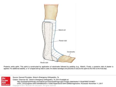 Posterior ankle splint