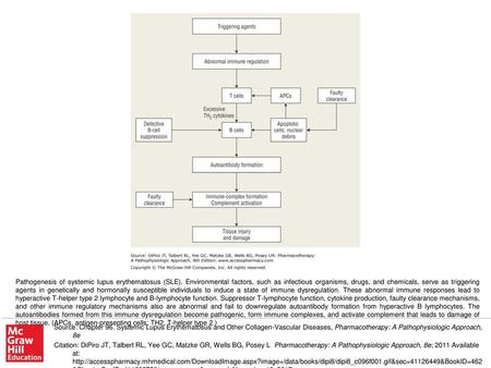 Pathogenesis of systemic lupus erythematosus (SLE)