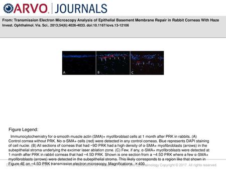 From: Transmission Electron Microscopy Analysis of Epithelial Basement Membrane Repair in Rabbit Corneas With Haze Invest. Ophthalmol. Vis. Sci.. 2013;54(6):4026-4033.