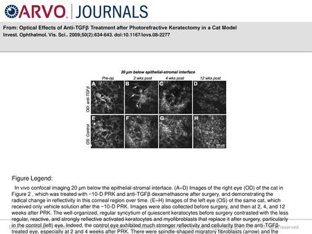 Invest. Ophthalmol. Vis. Sci ;50(2): doi: /iovs Figure Legend: