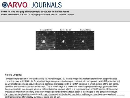 From: In Vivo Imaging of Microscopic Structures in the Rat Retina