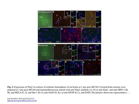 Fig. 2. Expression of Ninj1 in cortices of ischemic hemispheres of rat brains at 1 day post-MCAO. Coronal brain sections were prepared at 1 day post-MCAO.