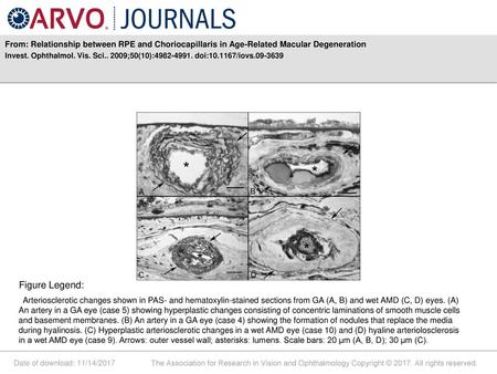 Invest. Ophthalmol. Vis. Sci ;50(10): doi: /iovs Figure Legend: