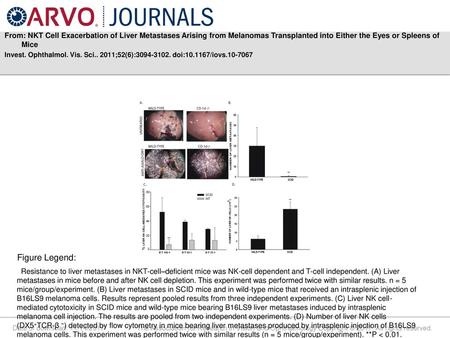 From: NKT Cell Exacerbation of Liver Metastases Arising from Melanomas Transplanted into Either the Eyes or Spleens of Mice Invest. Ophthalmol. Vis. Sci..