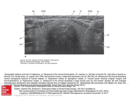 Sonographic patterns and risk of malignancy. A