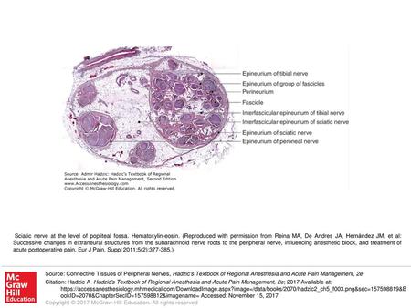 Sciatic nerve at the level of popliteal fossa. Hematoxylin-eosin