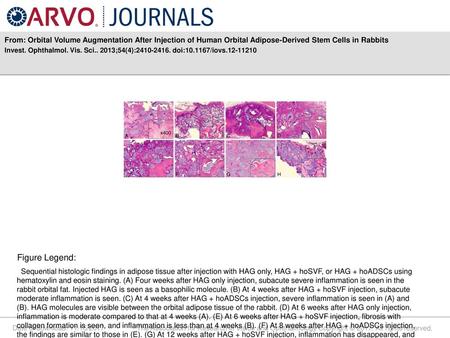 From: Orbital Volume Augmentation After Injection of Human Orbital Adipose-Derived Stem Cells in Rabbits Invest. Ophthalmol. Vis. Sci.. 2013;54(4):2410-2416.