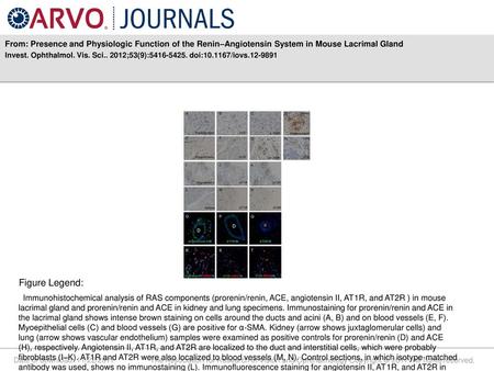 Invest. Ophthalmol. Vis. Sci ;53(9): doi: /iovs Figure Legend: