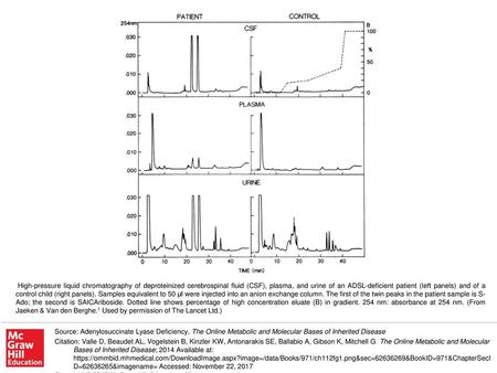 High-pressure liquid chromatography of deproteinized cerebrospinal fluid (CSF), plasma, and urine of an ADSL-deficient patient (left panels) and of a control.