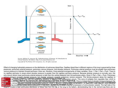 (Adapted and reprinted with permission, from Hughes JM et al: Effect of lung volume on the distribution of pulmonary blood flow in man. Respir Physiol.