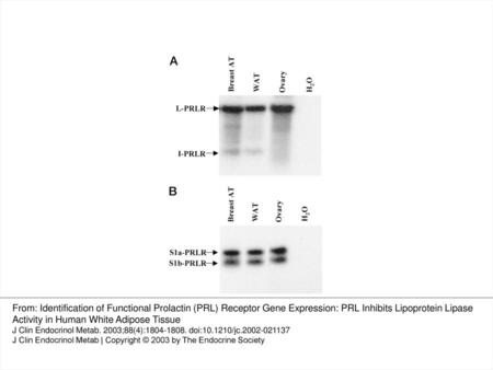 Figure 1. Analysis of four different hPRLR mRNA isoforms (L, I, S1a, and S1b) in human breast adipose tissue (Breast AT), sc abdominal.