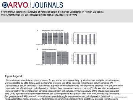 Invest. Ophthalmol. Vis. Sci ;53(13): doi: /iovs Figure Legend: