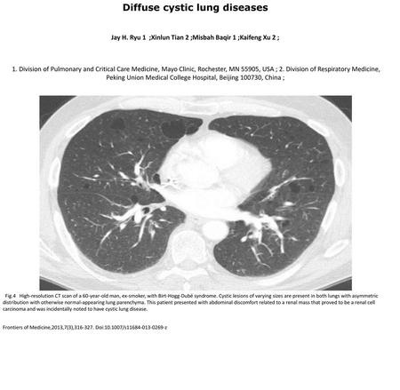 Diffuse cystic lung diseases