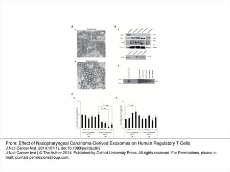 Figure 1. Phenotypic and functional characterization of nasopharyngeal carcinoma (NPC)– and healthy donor (HD)–derived exosomes. A) Electron microscopy.