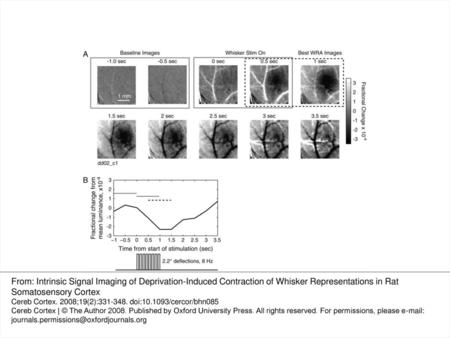 Figure 1. Whisker-evoked intrinsic signal in S1