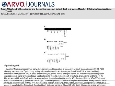 From: Mitochondrial Localization and Ocular Expression of Mutant Opa3 in a Mouse Model of 3-Methylglutaconicaciduria Type III Invest. Ophthalmol. Vis.