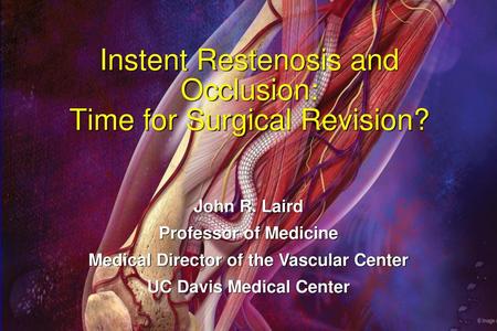 Instent Restenosis and Occlusion: Time for Surgical Revision?