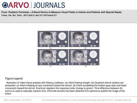 From: Pediatric Perimeter—A Novel Device to Measure Visual Fields in Infants and Patients with Special Needs Trans. Vis. Sci. Tech.. 2017;6(4):3. doi:10.1167/tvst.6.4.3.