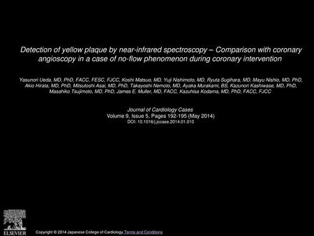 Detection of yellow plaque by near-infrared spectroscopy – Comparison with coronary angioscopy in a case of no-flow phenomenon during coronary intervention 