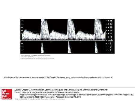 Aliasing on a Doppler waveform, a consequence of the Doppler frequency being greater than having the pulse repetition frequency. Source: Chapter 2. Instrumentation,