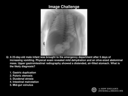 Image Challenge Q: A 23-day-old male infant was brought to the emergency department after 5 days of increasing vomiting. Physical exam revealed mild dehydration.