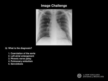 Image Challenge Q: What is the diagnosis? 1. Coarctation of the aorta