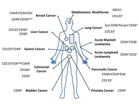 Glioblastoma Multiforme SSEA1+ CD133+