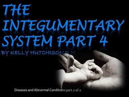 The integumentary system Part 4 by Kelly Hutchison R.n.