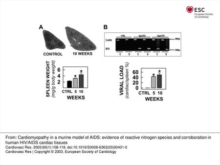 Fig. 1 Splenomegaly and increased viral load in cardiac and splenic tissue during the progression of murine AIDS. Panel A: Upper panel–representative Hematoxylin.