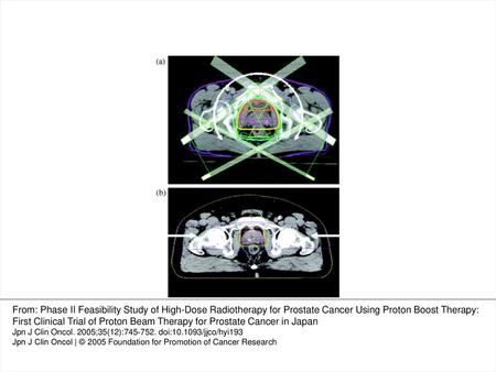 Figure 1. (a) Dose distribution of dynamic conformal photon therapy