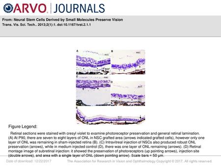 From: Neural Stem Cells Derived by Small Molecules Preserve Vision