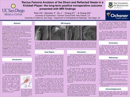 Rectus Femoris Avulsion of the Direct and Reflected Heads in a Kickball Player: the long-term positive nonoperative outcome presented with MRI findings.