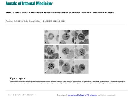 From: A Fatal Case of Babesiosis in Missouri: Identification of Another Piroplasm That Infects Humans Ann Intern Med. 1996;124(7):643-650. doi:10.7326/0003-4819-124-7-199604010-00004.