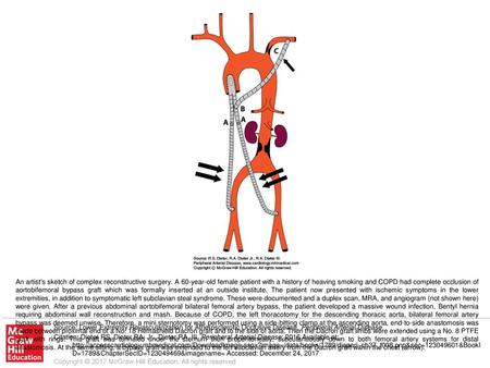 An artist's sketch of complex reconstructive surgery