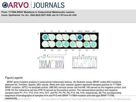 From: T1799A BRAF Mutations in Conjunctival Melanocytic Lesions